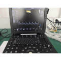 4D Color Ultrasound Doppler Probe Machine